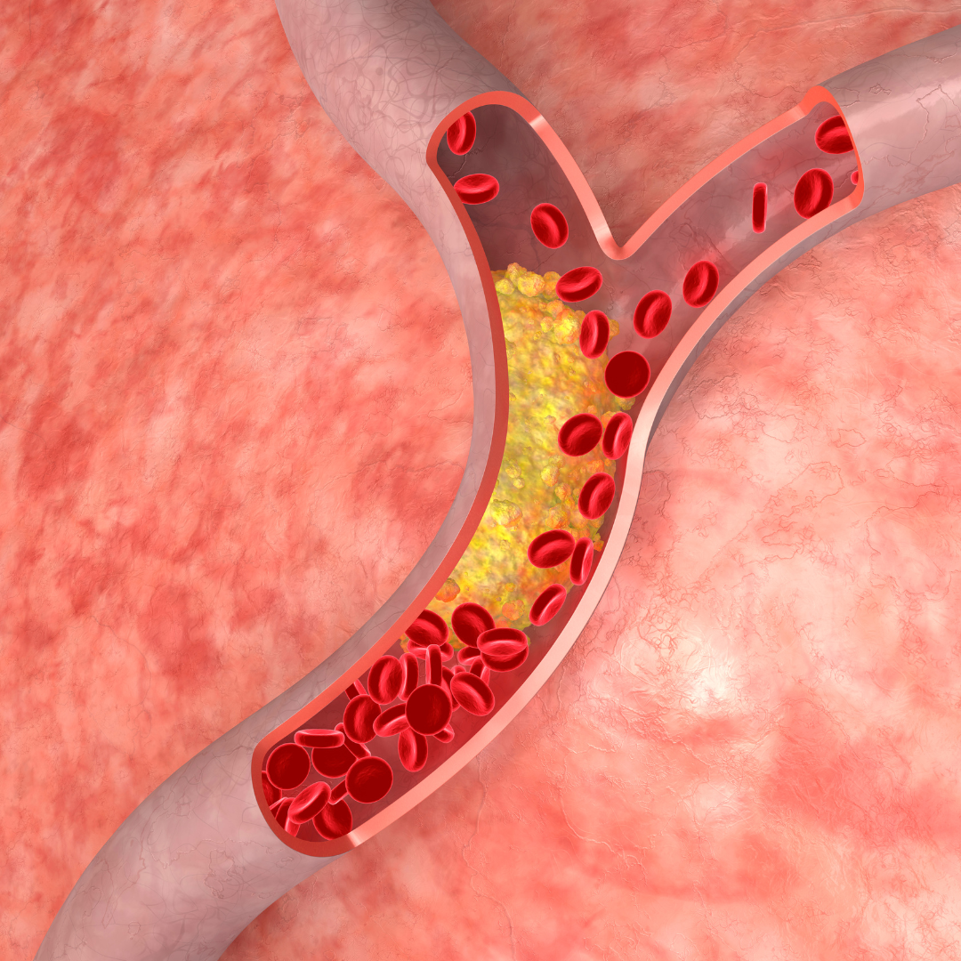 does-dietary-cholesterol-influence-your-blood-cholesterol-by-nutritionist-vasundhara-agrawal